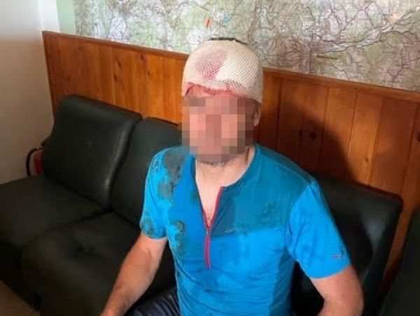 Medveďom napadnut&yacute; z&aacute;chran&aacute;r 